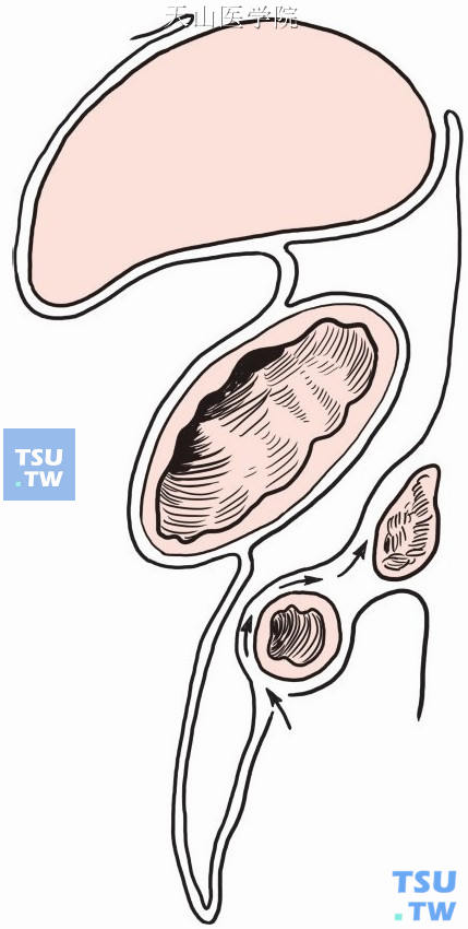 剥离大网膜及横结肠系膜前叶