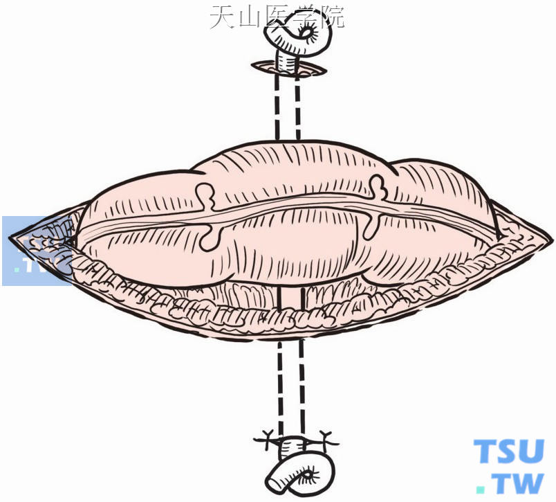 硬塑料管作为支撑管