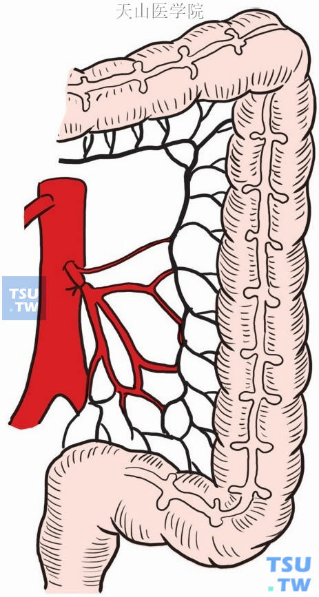 显露肠系膜下动脉根部