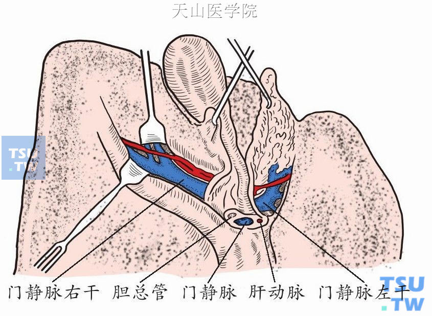 第一肝门解剖