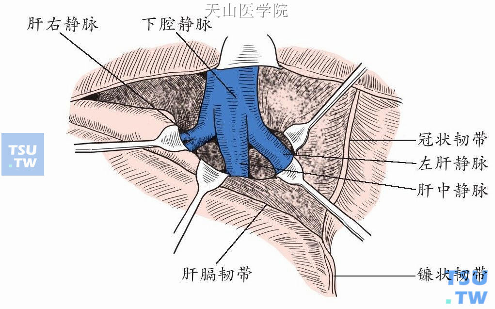 肝圆韧带解剖图片