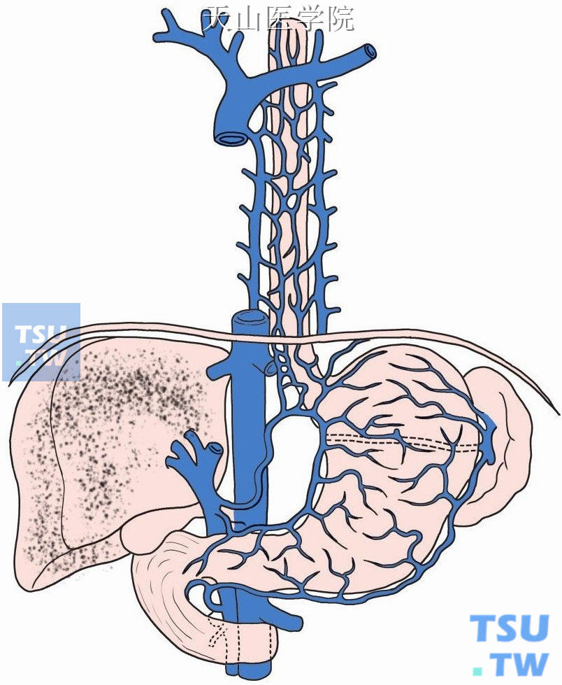食管胃底贲门区的主要门奇静脉交通支