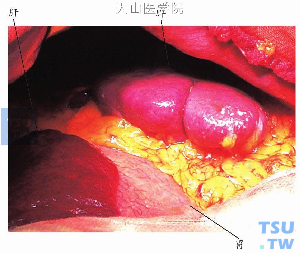 同时应关注肝脏的大小、硬变程度、脾脏的位置、有无占位病变等细节