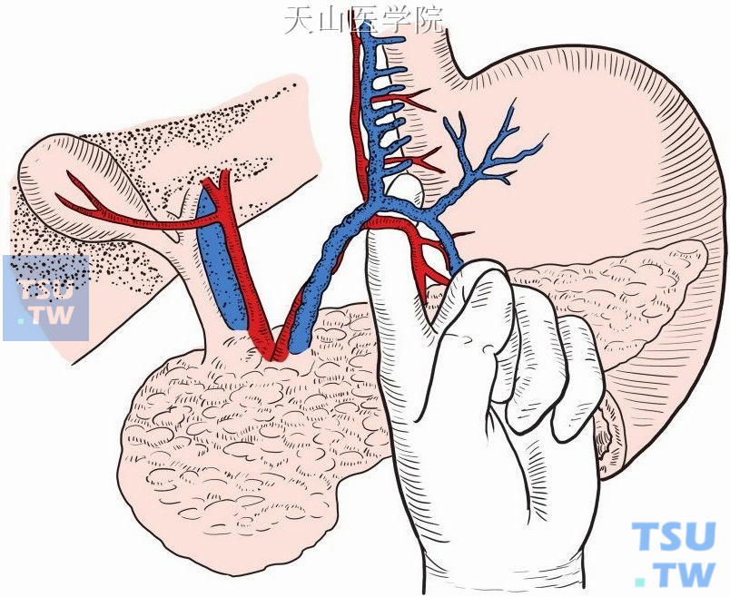 以手指钝性分离胃左动（静）脉的胃支