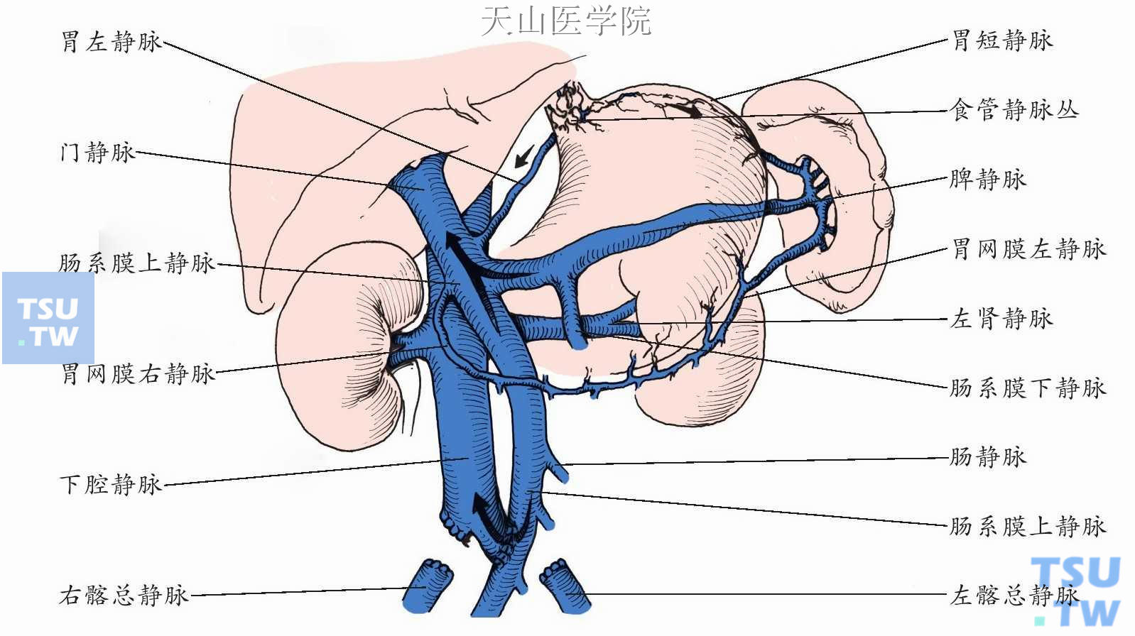 肠腔静脉侧端分流术示意如图