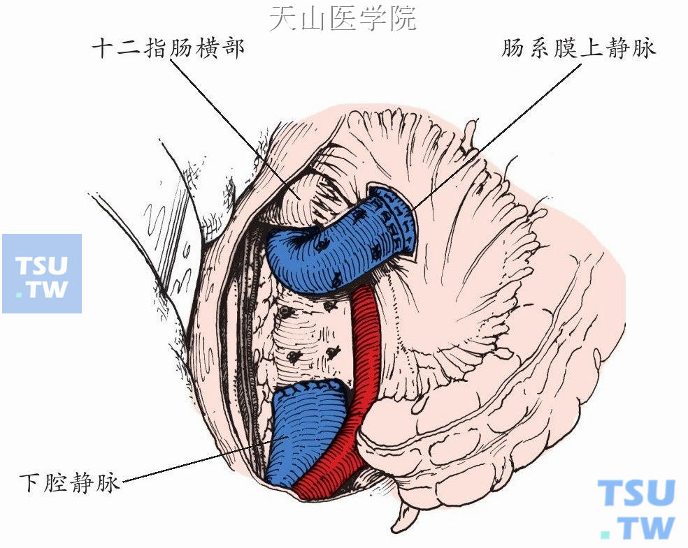 连续缝合血管前壁