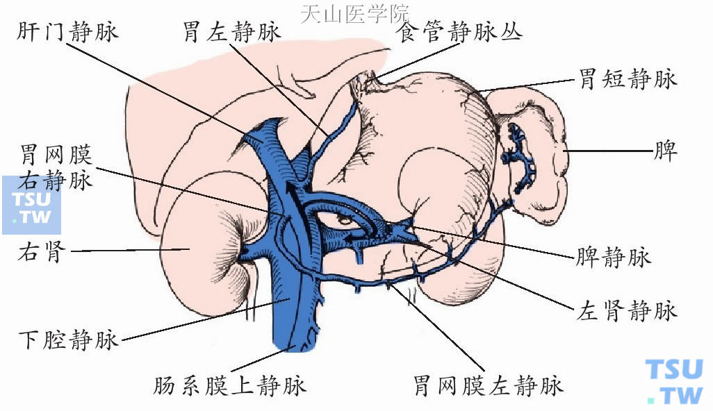 脾肾静脉分流术局部解剖如图