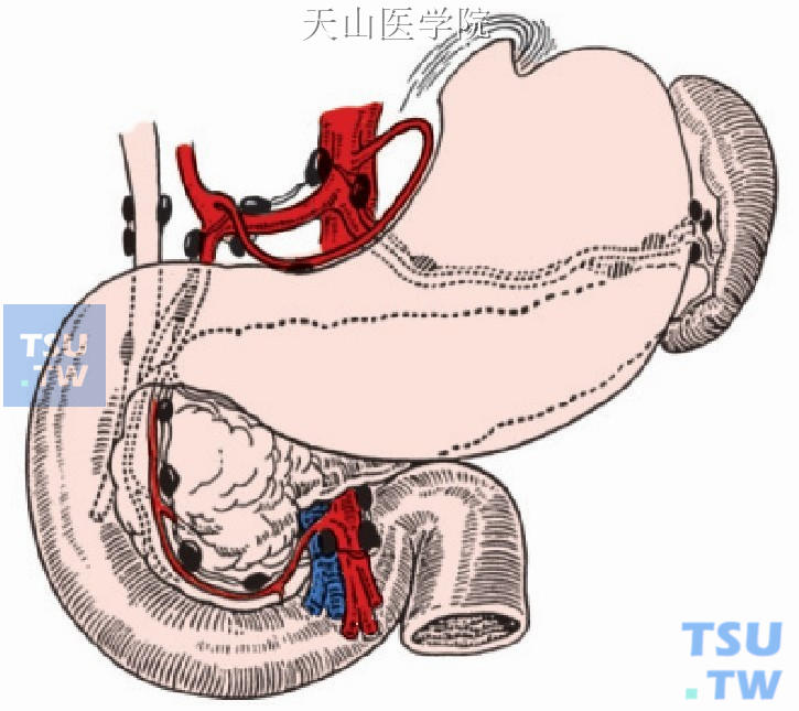 胰腺的淋巴引流