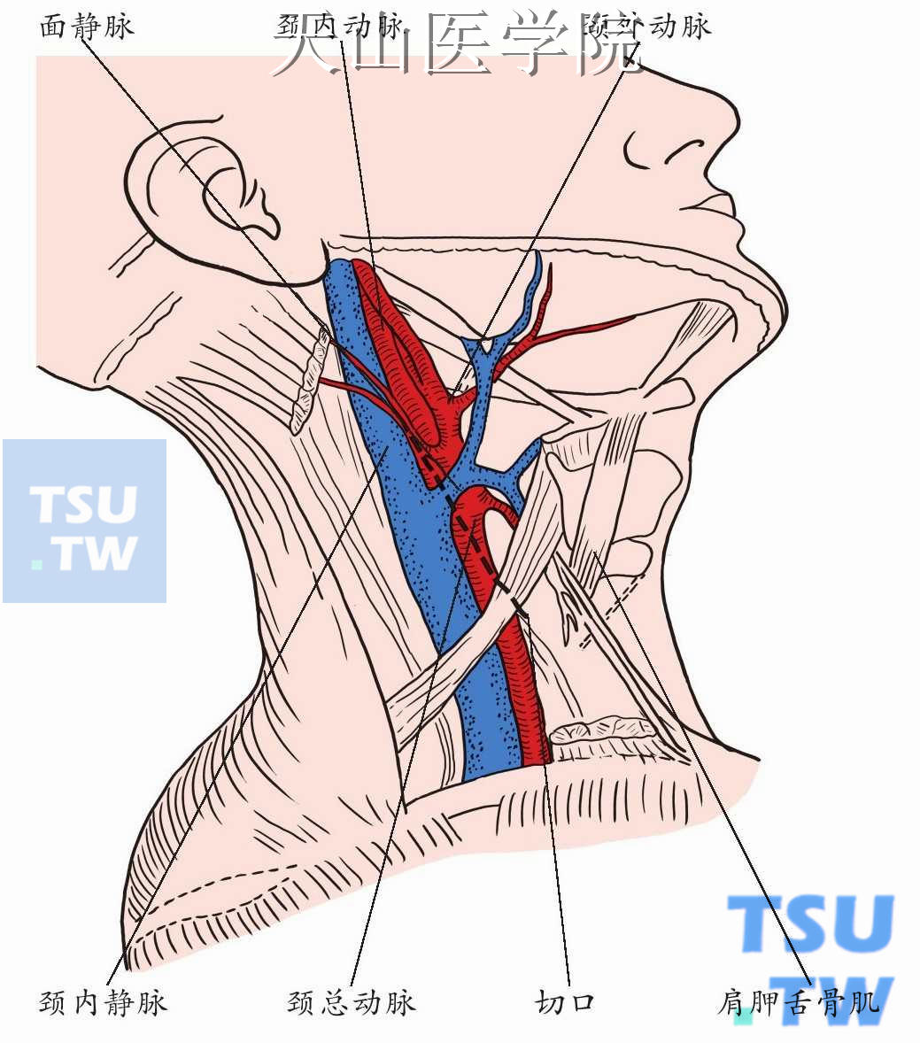 颈动脉鞘的结构图片