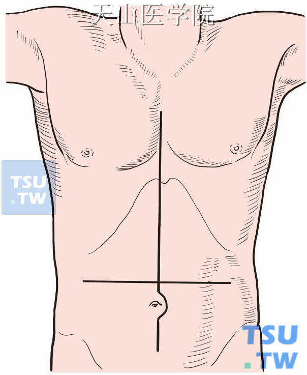 一般选用正中胸腹联合切口，从胸骨切迹至耻骨联合，劈开胸骨，剪开心包，向后剪开部分膈肌。必要时可以加做中腹部横切口