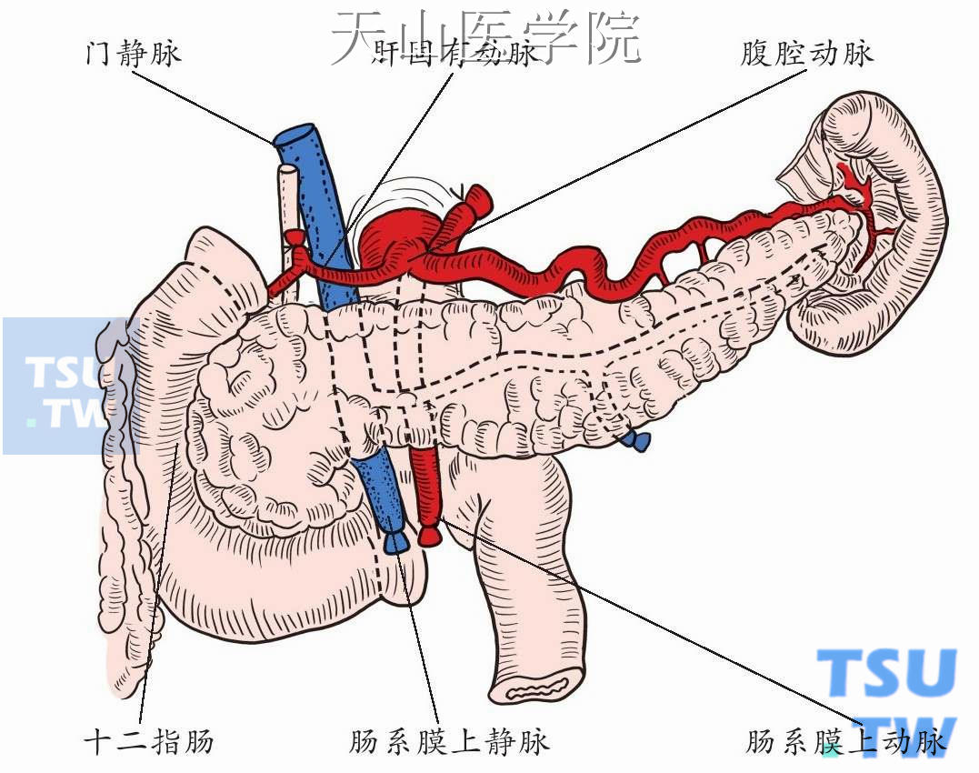 供胰修整后示意图