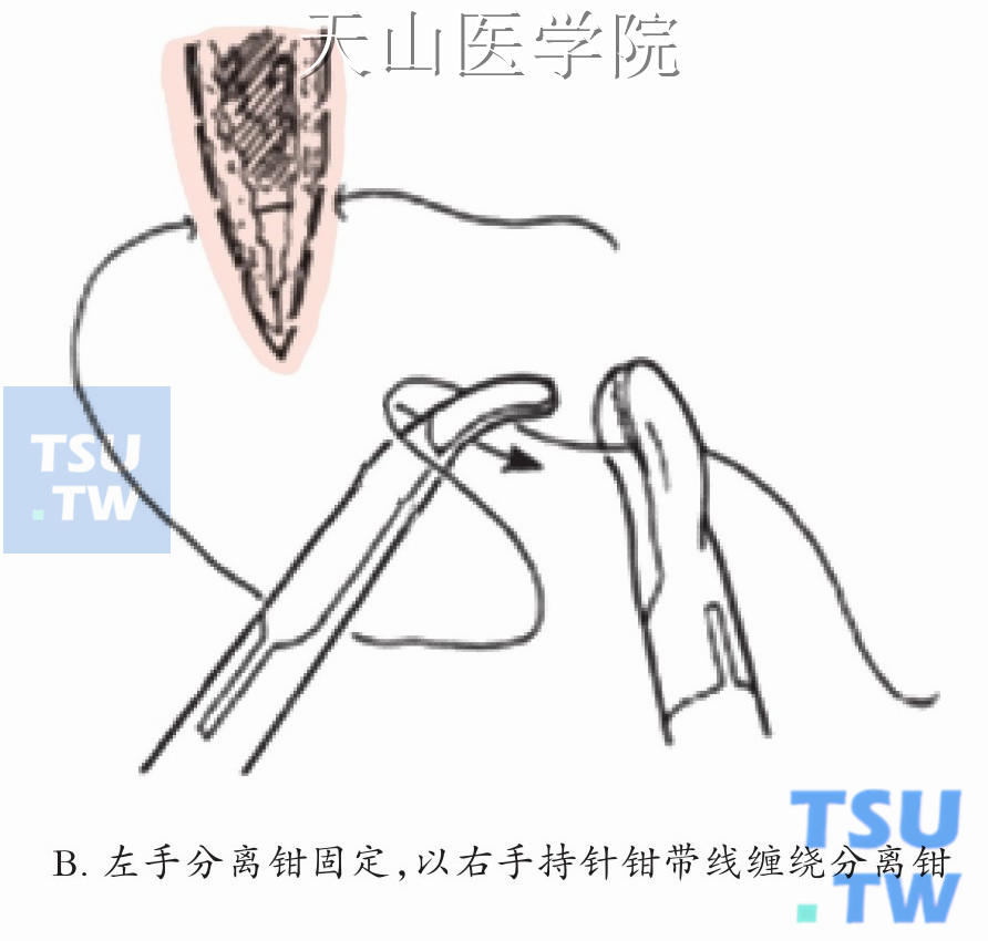 打结流程示意图