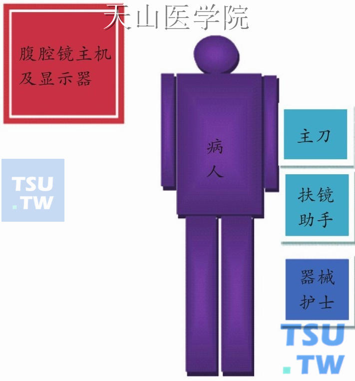 腹腔镜阑尾切除术手术组的位置