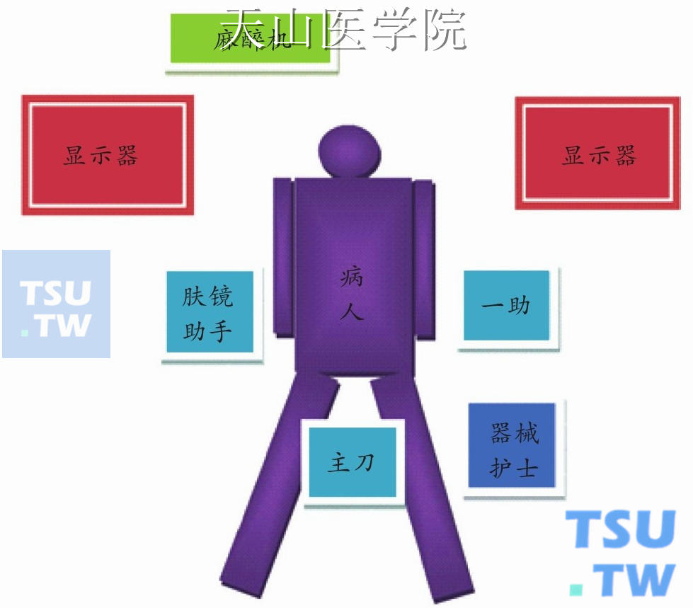 前路手术病人体位及手术组站位示意图