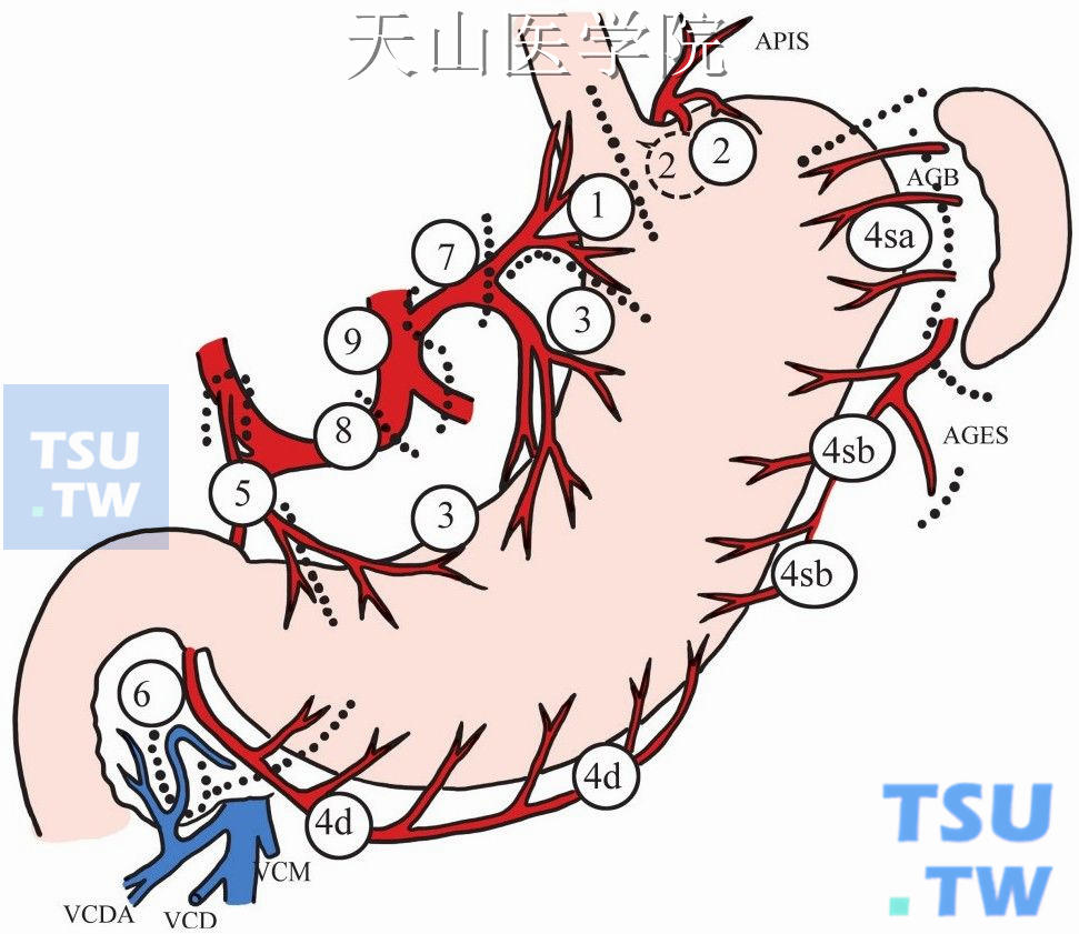 胃淋巴结分区图片