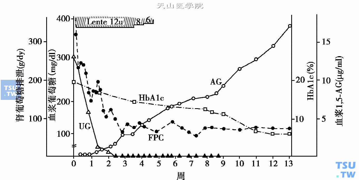 胰岛素治疗后空腹血糖（FPG）、HbA1c、24小时尿糖（UG）及1，5-AG变化情况（引自Yamanouchi T等. Diabetes，1989，38：725）