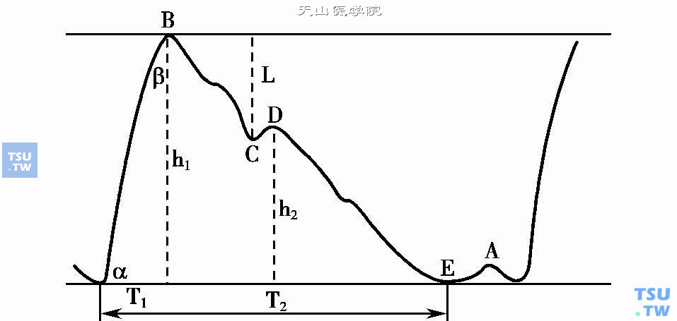  阻抗血流图示意图