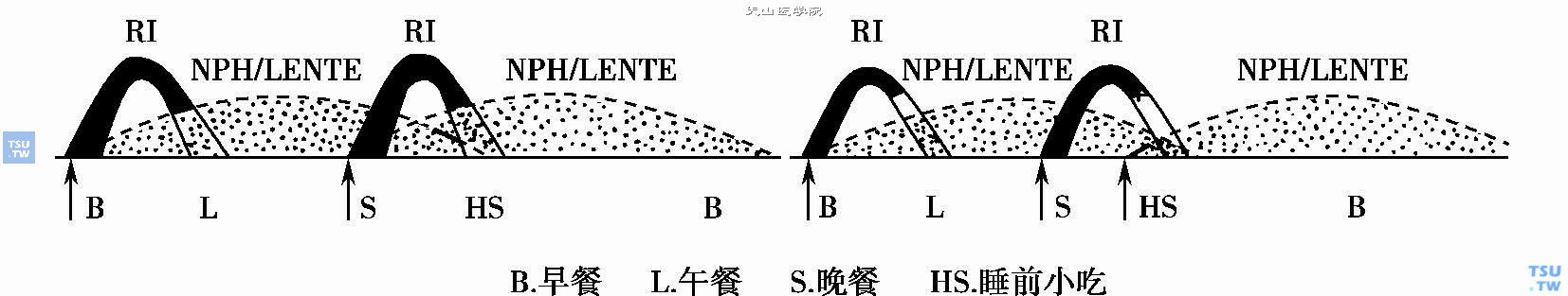 中效胰岛素NPH晚餐前和睡前注射的不同时效（仿Joslin，1994）