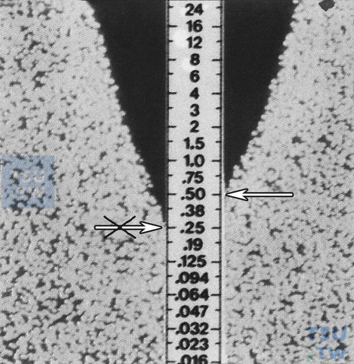 E-test试验结果试剂条两边抑菌圈高度不等时应如何阅读？