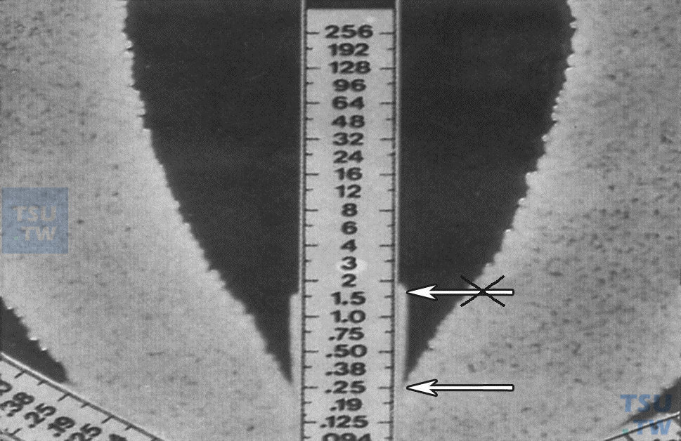 E-test试验结果试剂条边缘有细菌生长时应如何阅读？