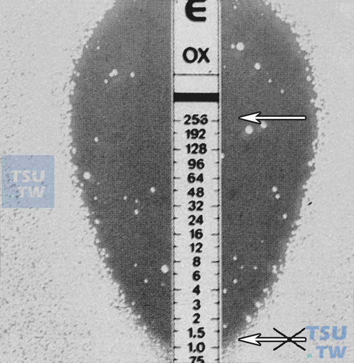 如何阅读变形杆菌的E-test结果？