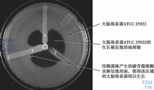  改良Hodge试验检测碳青霉烯酶