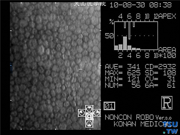 正常眼角膜角膜内皮显微镜图像
