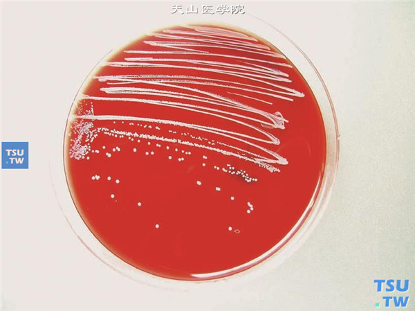 细菌性角膜炎，角膜病灶刮片采集标本接种在血平皿上培养，图为阳性标本转种血平皿24小时后外观