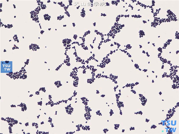 上述标本经微生物鉴定仪鉴定，结果为表皮葡萄球菌，Gram染色在显微镜（×1000）下观察的图像