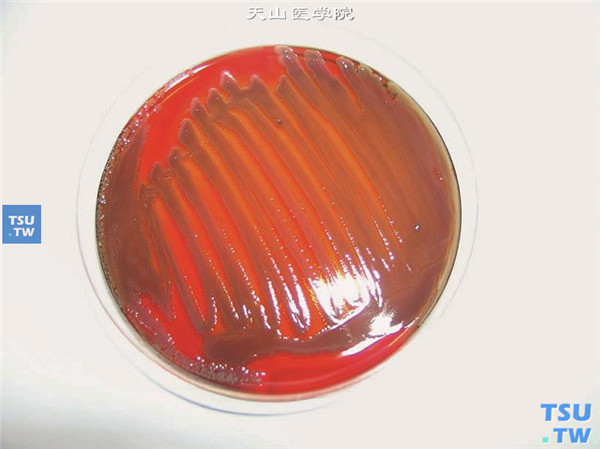 细菌性角膜炎，病灶刮片采集标本接种在血平皿上培养，图为阳性标本转种血平皿24小时后外观