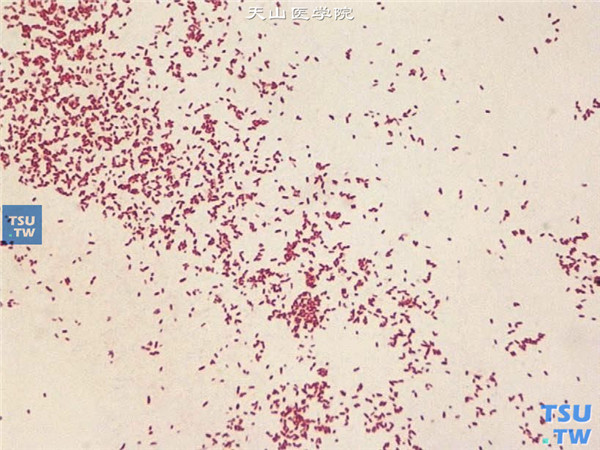上述标本，细菌鉴定结果为铜绿假单胞菌，Gram染色在显微镜（×1000）下观察的图像