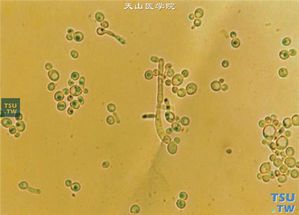 白色念珠菌孢子图片