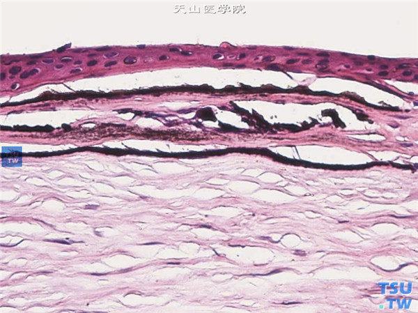 角膜带状变性，钙盐染色×400