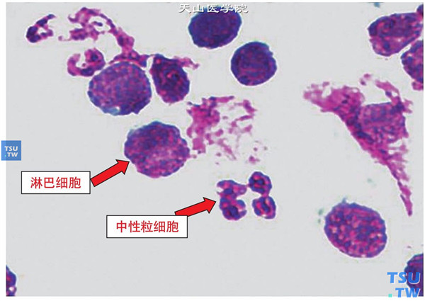 wright-giemsa染色法图片