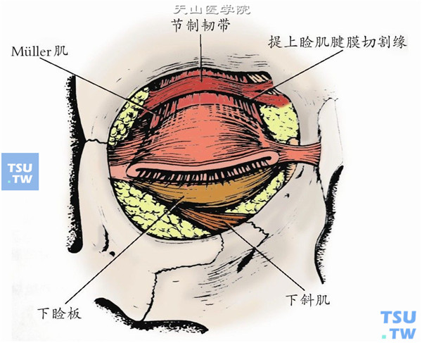提上睑肌解剖