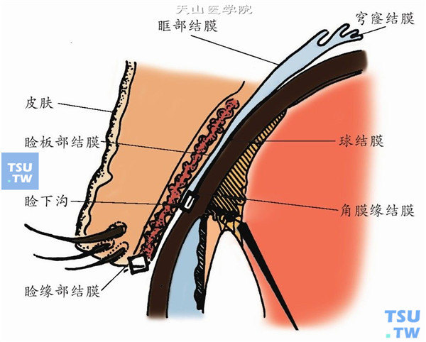 结膜手术应用解剖