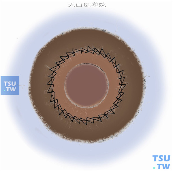 双连续缝合可抵消单连续缝合单向拉力的扭转作用，故称为抗扭转缝合