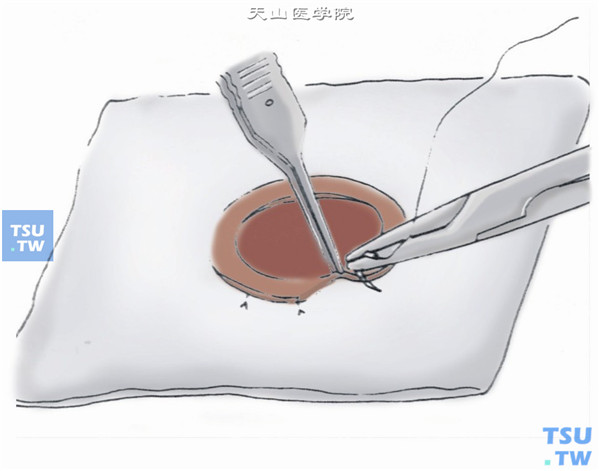 剖切法：在角膜片上制取移植片：此法通常是在灭活保存的角膜片上进行，干燥保存或甘油保存的角膜片复水，待角膜片恢复透明柔软之后，将角膜片的后半层缝合于纱布团上，然后用刀片剖切所需板层植片