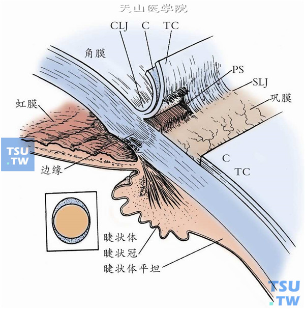 解剖示意图，SLJ：巩膜缘相接部位；CLJ：角膜缘相接部位；C：球结膜TC：球筋膜；PS：巩膜突角巩膜缘上方最宽，两侧最窄