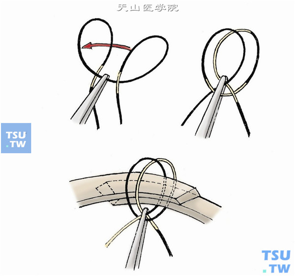 医用双套结打法图片