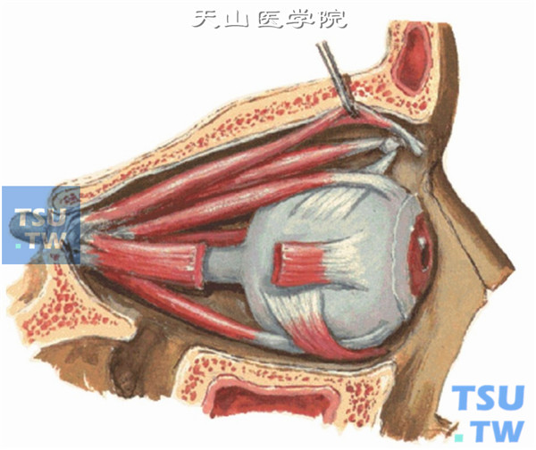 眼部肌肉（下斜肌走行侧面观）